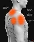 Graphic showing the position of the heated shoulder wrap on the shoulder